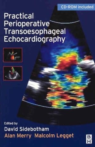 PRACTICAL PERIOPERATIVE TRANSOESOPHAGEAL ECHOCARDIOGRAPHY: By David Sidebotham