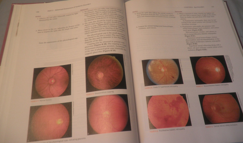 Advanced Health Assessment and Diagnostic Reasoning-Like New-HC-Free Shipping gallery