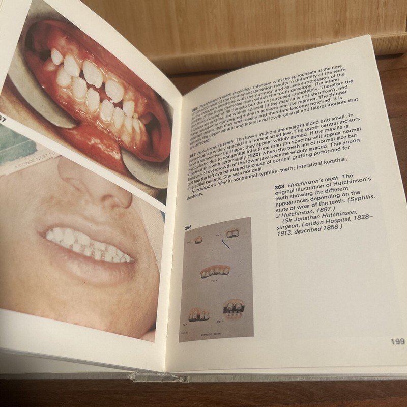 Physical Signs In General Medicine Wolfe Medical Atlases 1976 (R5.3) gallery