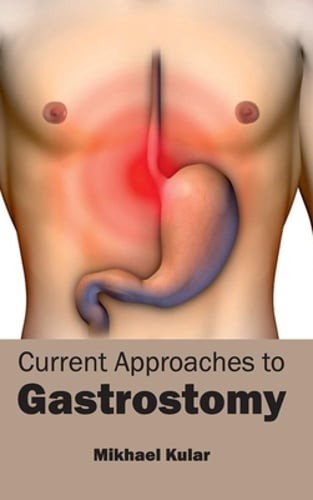 Current Approaches to Gastrostomy by Mikhael Kular: New