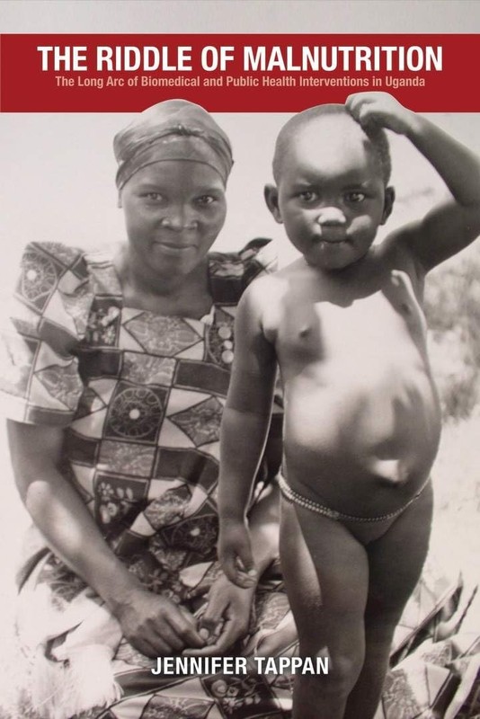 The Riddle of Malnutrition: The Long Arc of Biomedical and Public Health Int…