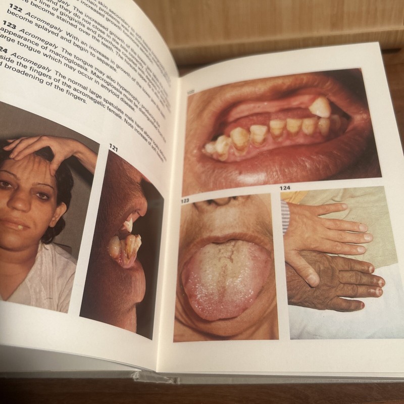Physical Signs In General Medicine Wolfe Medical Atlases 1976 (R5.3) gallery
