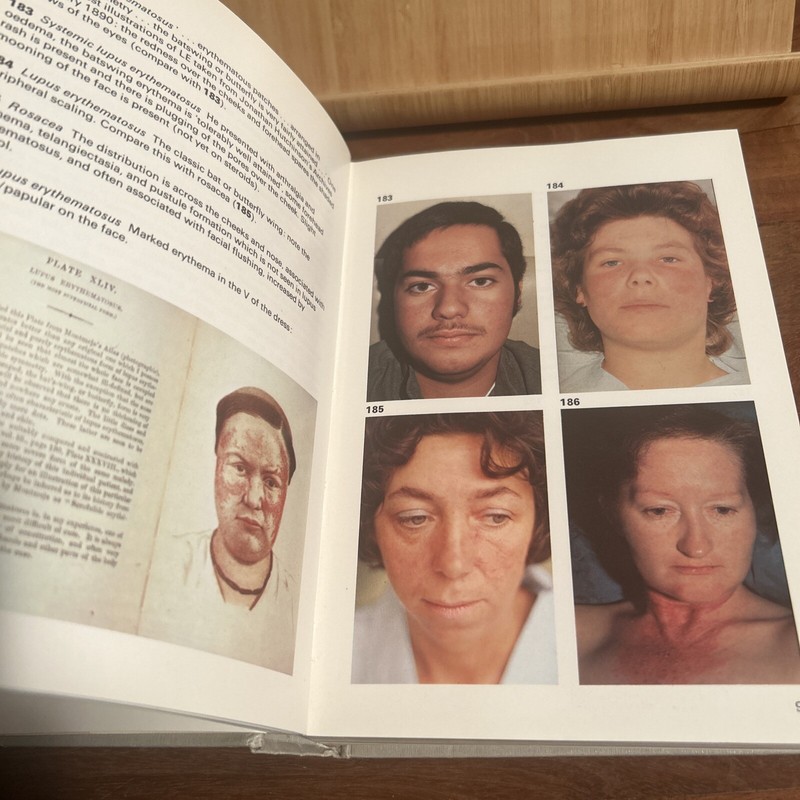 Physical Signs In General Medicine Wolfe Medical Atlases 1976 (R5.3) gallery