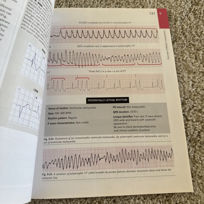 Hartman's Complete Guide for the EKG Technician Paperback Wilma L gallery