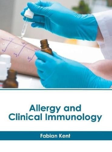 Fabian Kent Allergy and Clinical Immunology (Hardback)