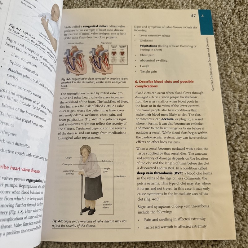 Hartman's Complete Guide for the EKG Technician Paperback Wilma L gallery