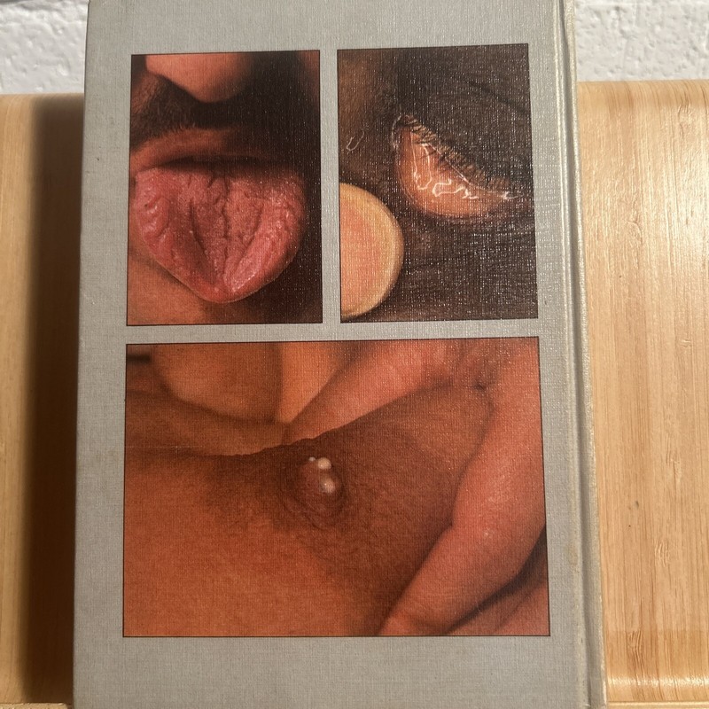 Physical Signs In General Medicine Wolfe Medical Atlases 1976 (R5.3) gallery