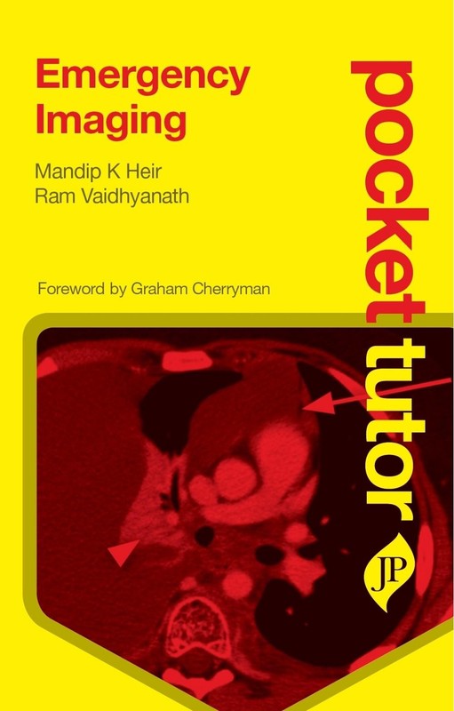 Pocket Tutor Emergency Imaging: Second Edition by Mandip K. Heir (English) Paper