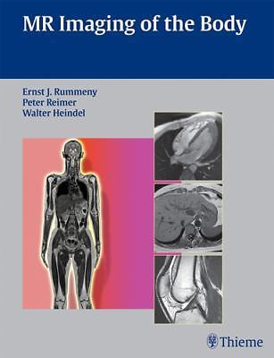 MR Imaging of the Body, , 9783131358417