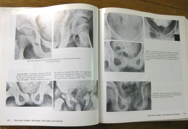 Atlas of Normal Roentgen Variants by Theo Keats 3rd Ed HC gallery
